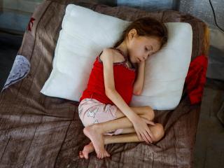 Una niña palestina con malnutrición.