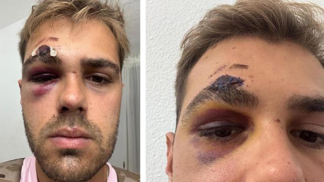 La imagen de cómo quedó su rostro.