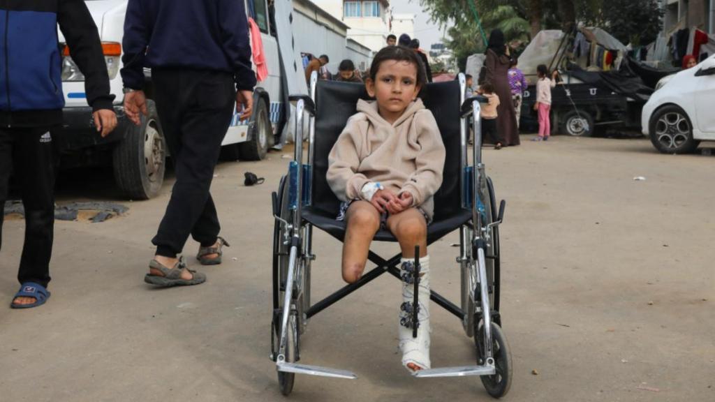 Noor perdió la pierna derecha después de que una explosión alcanzase se casa en Gaza.