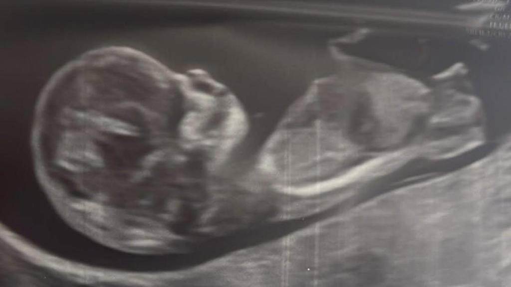 El mayor regalo que nos ha hecho la vida, escriben Alberto Herrera y Blanca Llandres al anunciar que esperan su primer hijo en común.