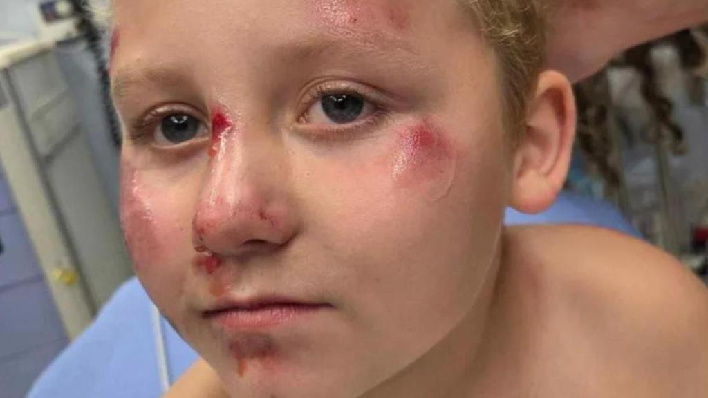 Un niño de Texas es atropellado por una camioneta mientras iba en bicicleta