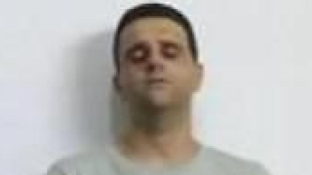 Felipe junior, tras ser detenido, junto a una imagen de su puño lesionado tras darle una paliza a su padre.