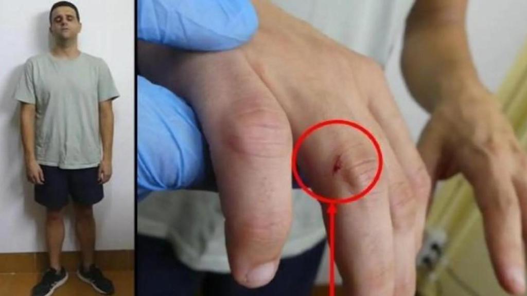 Felipe junior, tras ser detenido, mostrando sus nudillos ensangrentados por la paliza que le propinó a su padre.