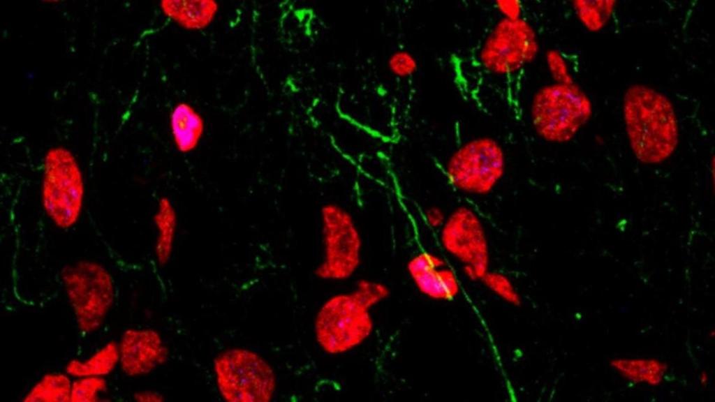Células madre en división en el hipocampo humano adulto. / LlorensLab