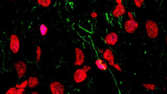 Células madre en división en el hipocampo humano adulto. / LlorensLab