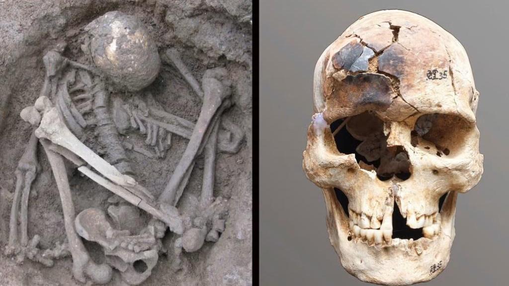Individuo joven de sexo masculino en posición hiperflexionada (izquierda) procedente del yacimiento de Liyupo, en Guangxi (China), de hace unos 7.000 años, con el cráneo parcialmente quemado (derecha).