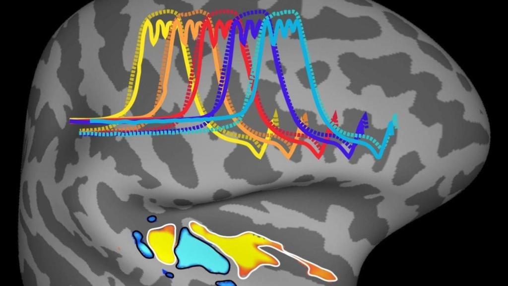 Archivo - Sonidos en el cerebro. Foto de archivo
