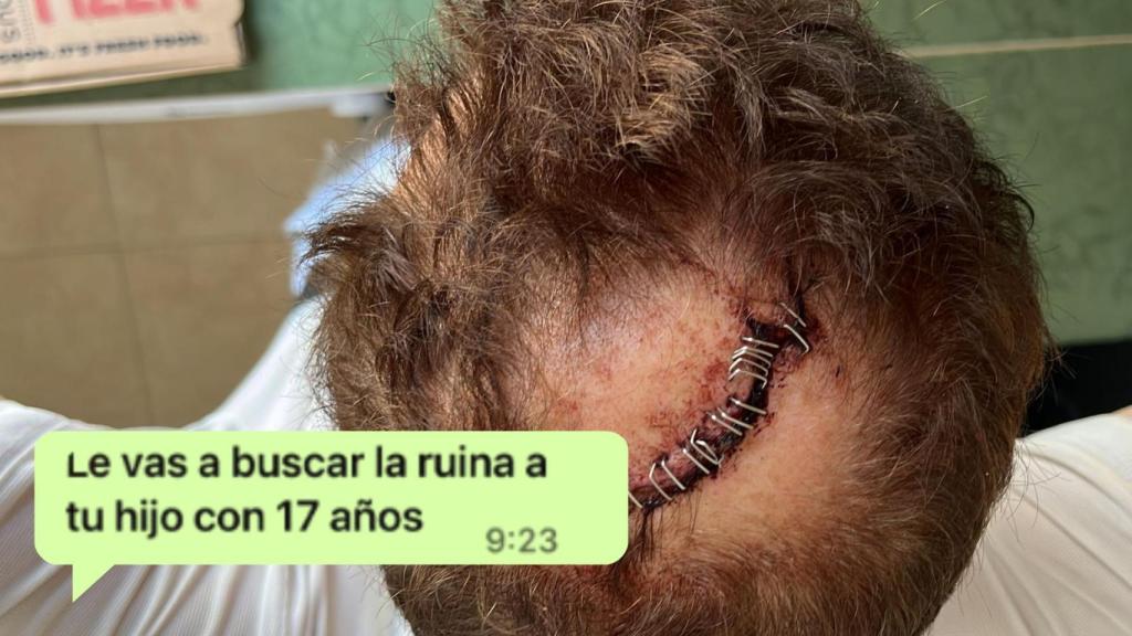Una imagen de cómo quedó la cabeza de Ricardo tras un suceso y un mensaje de su ex.