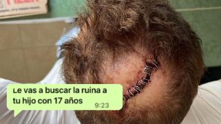 Una imagen de cómo quedó la cabeza de Ricardo tras un suceso y un mensaje de su ex.