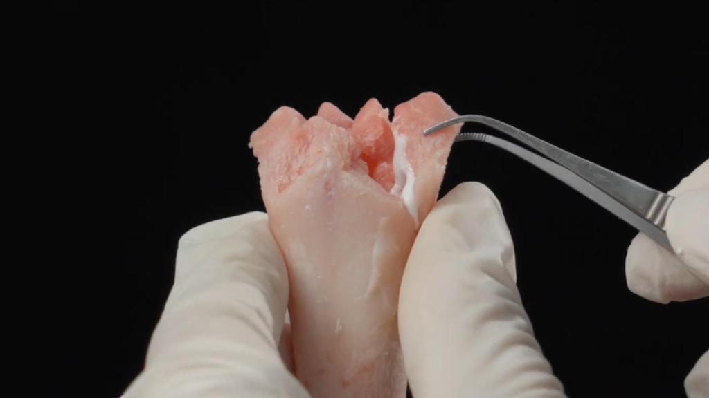 El biopegamento Bone 02 en un hueso.