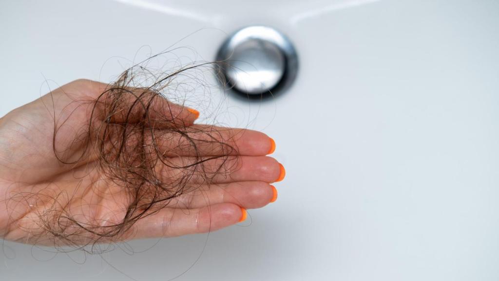 Imagen de ilustración.