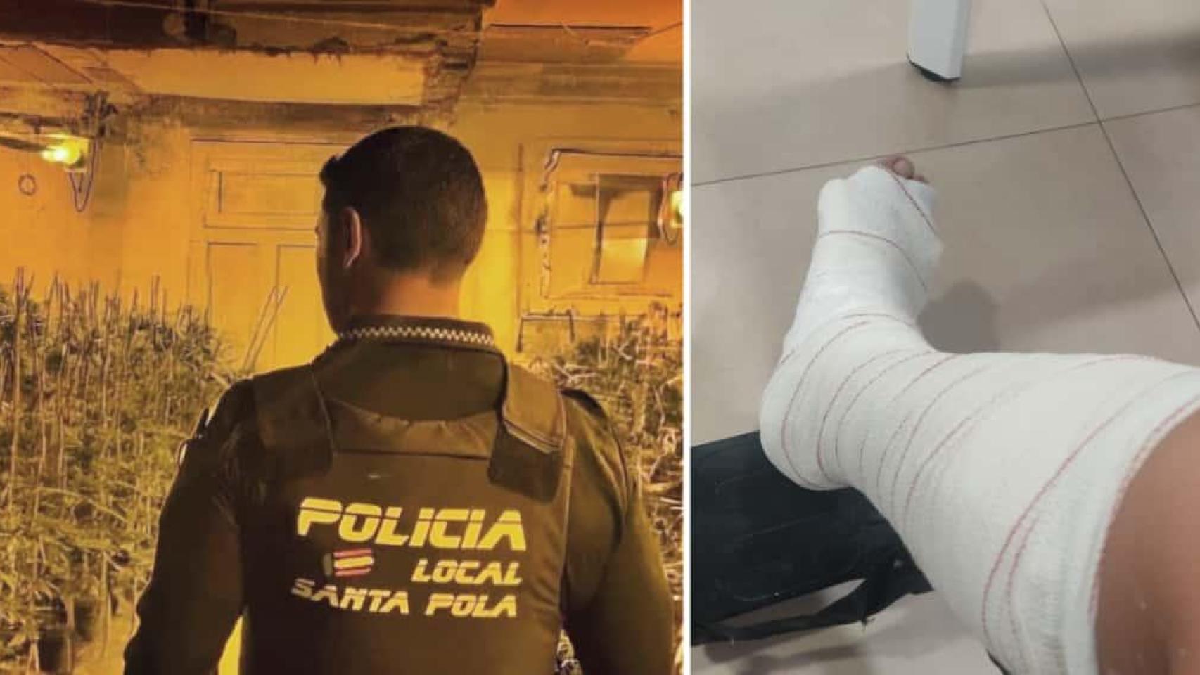 El policía local de Santa Pola en imagen de archivo y su pierna escayolada.