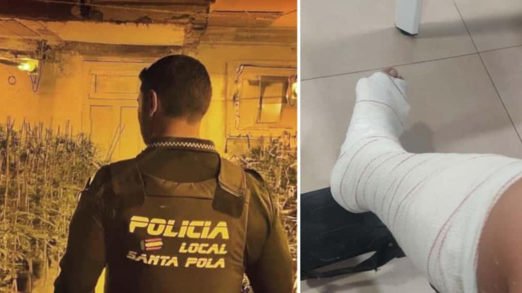 El policía local de Santa Pola en imagen de archivo y su pierna escayolada.