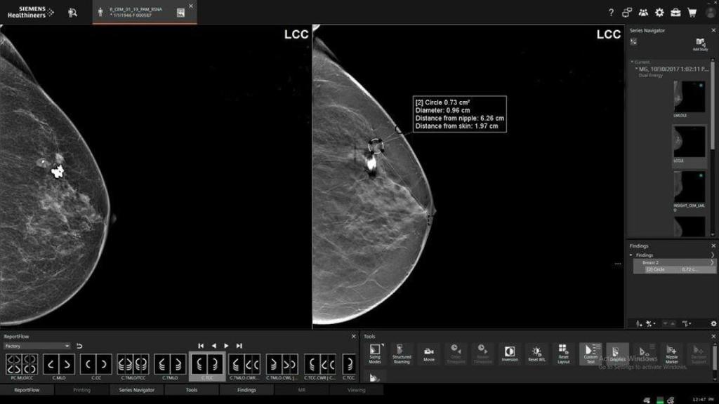 Pruebas de mama en una imagen de archivo.