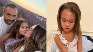 Priscila, antes y después de ser atacada por un perro.