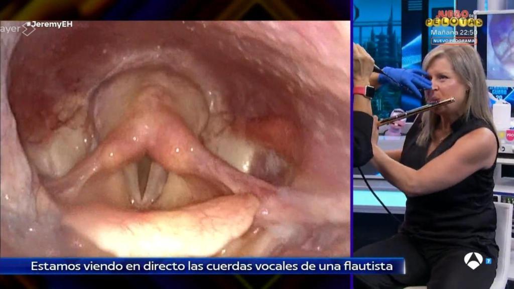 'El Hormiguero' muestra cómo son por dentro las cuerdas vocales de una flautista.