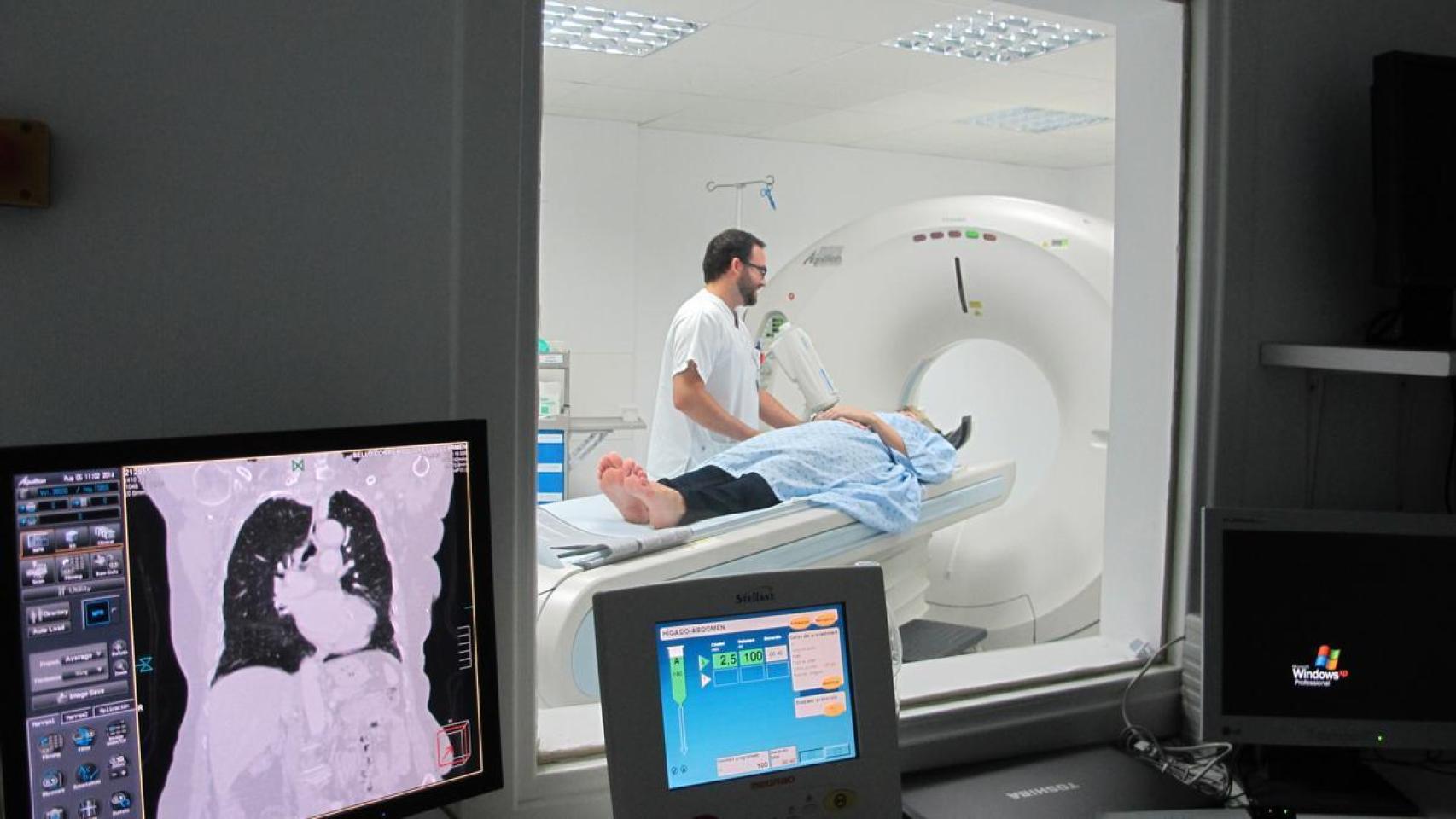 La detección temprana del cáncer de pulmón se realiza mediante TAC de baja dosis.