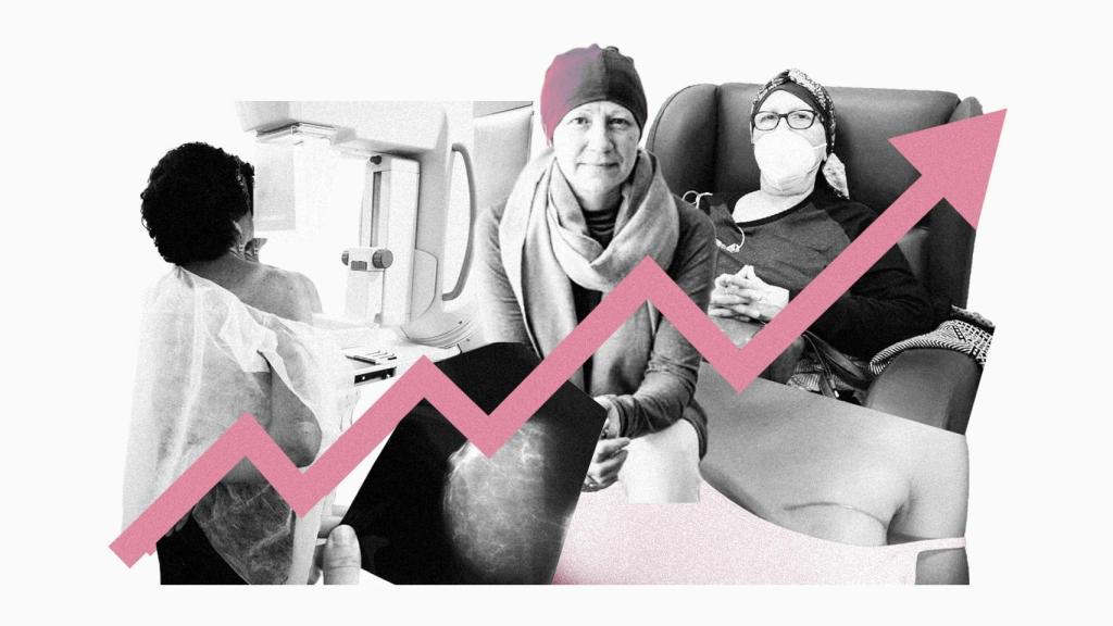 En España se diagnosticarán 37.682 nuevos casos de cáncer de mama este año.