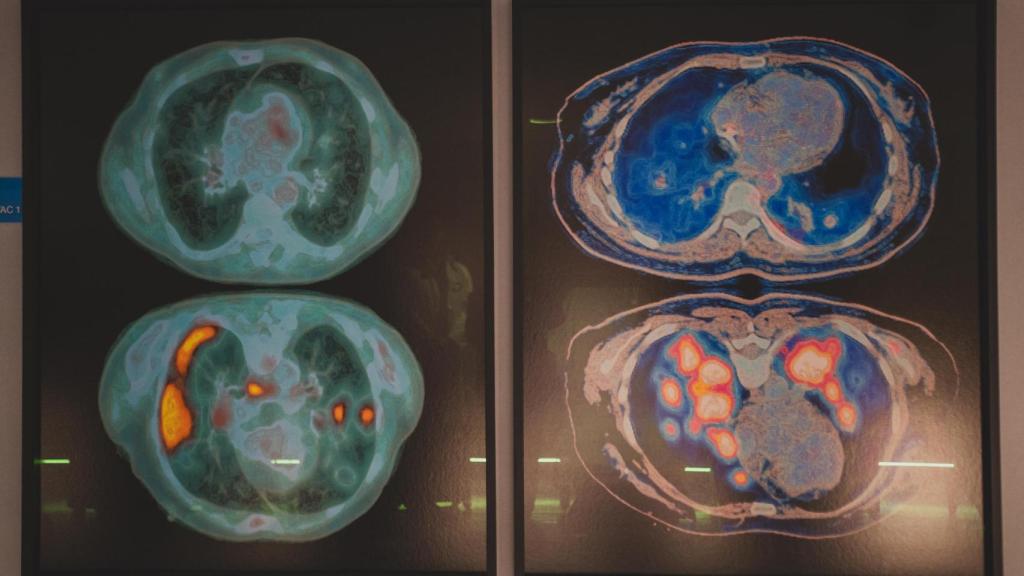 Obras de la serie Transfiguración de Rafael Díaz.