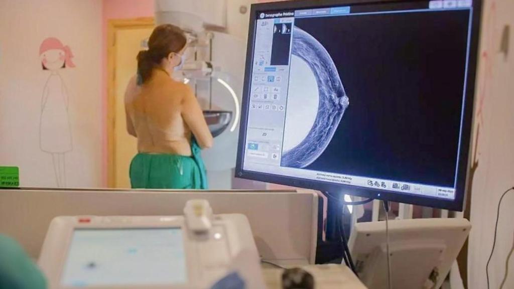 Una mujer se somete a una mamografía.