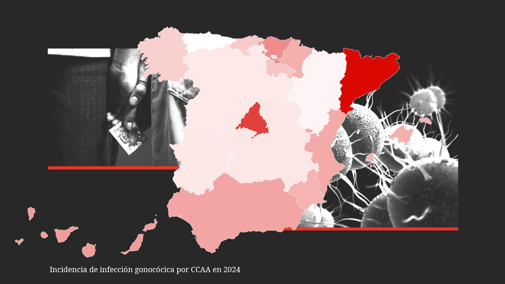 El sorprendente mapa de la gonorrea en España: por qué Cataluña tiene una tasa un 6.676% más alta que Asturias