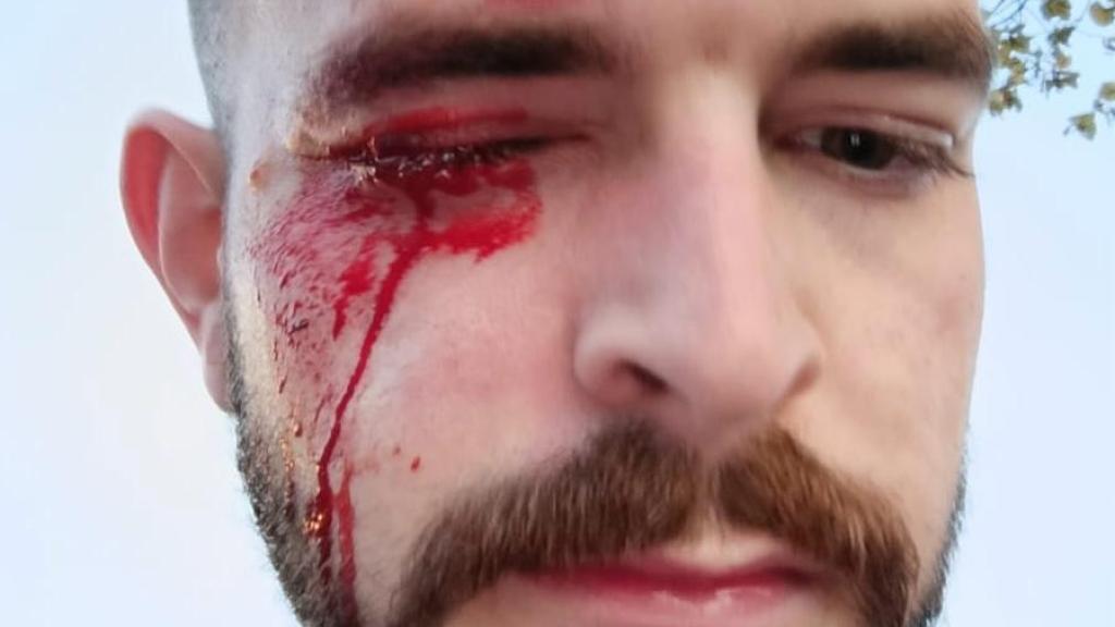 El periodista de EL ESPAÑOL José Ismael Martínez, justo después de la agresión.