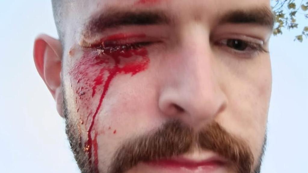 El periodista de EL ESPAÑOL José Ismael Martínez, justo después de la agresión.