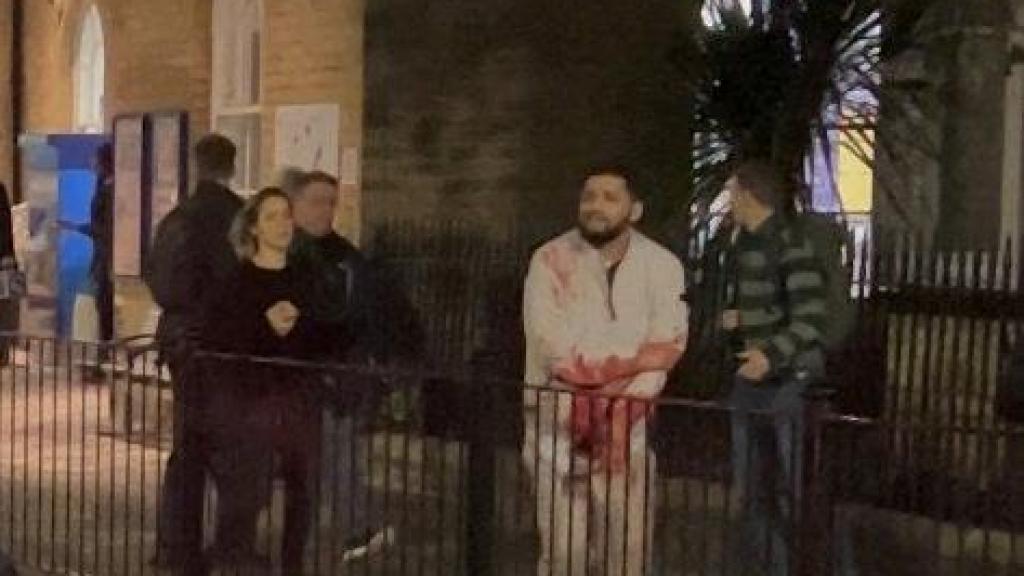 Un hombre herido camina por la acera tras un apuñalamiento en la estación de tren de Huntingdon.