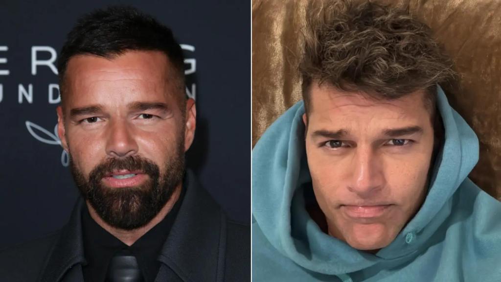 Ricky Martin, antes y después de su cambios estéticos.