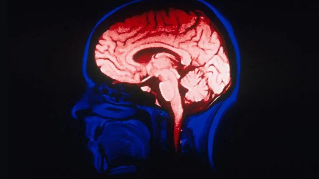 El proyecto BRAIN nació en 2013 impulsado por Obama.