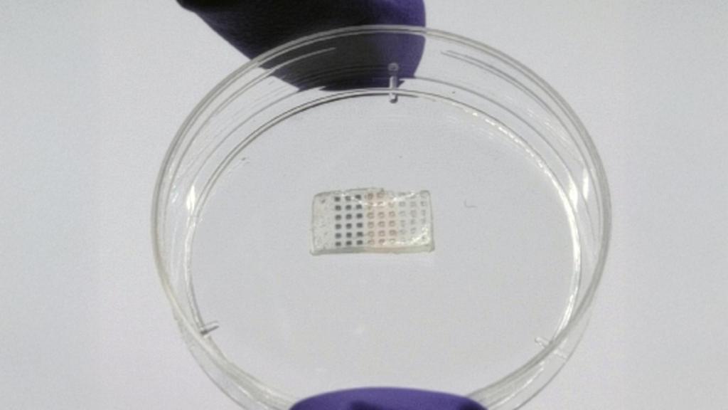 El parche para el corazón del MIT.