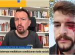 Pablo Iglesias plantea en falso y sin indicios que el periodista de El Español apaleado fuera un "infiltrado" de la Policía