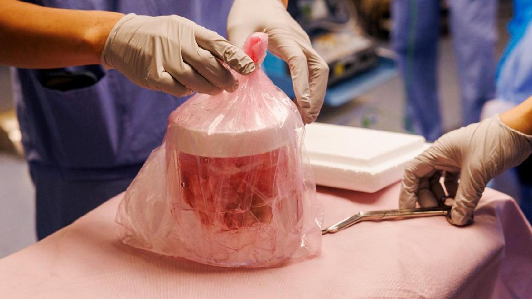 Un riñón de cerdo modificado genéticamente y listo para el trasplante.