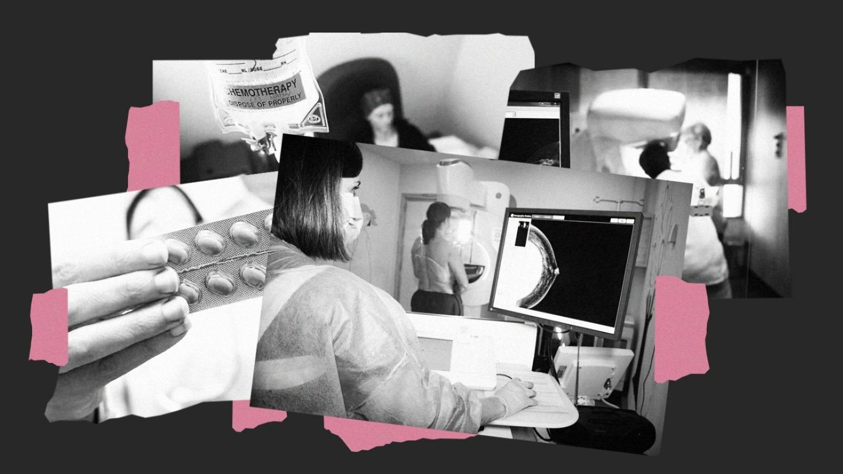 El 33% de las supervivientes de cáncer de mama en España abandona la terapia que evita recaídas:  No perciben el riesgo 