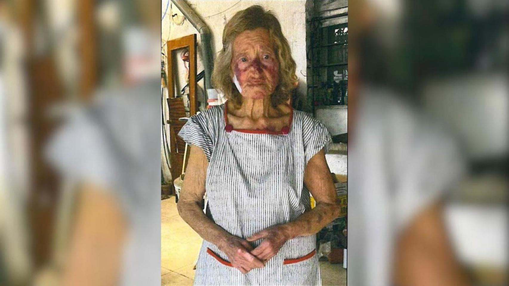 Pilar, de 88 años, tras ser secuestrada, maniatada y torturada por dos ladrones en Hellín.