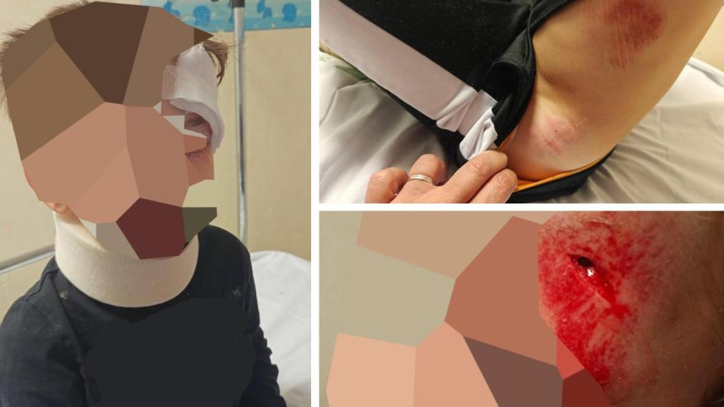 Imágenes del niño tras el atropello.