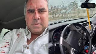 Перуански председнички кандидат Рафаел Белаунде после пуцњаве.