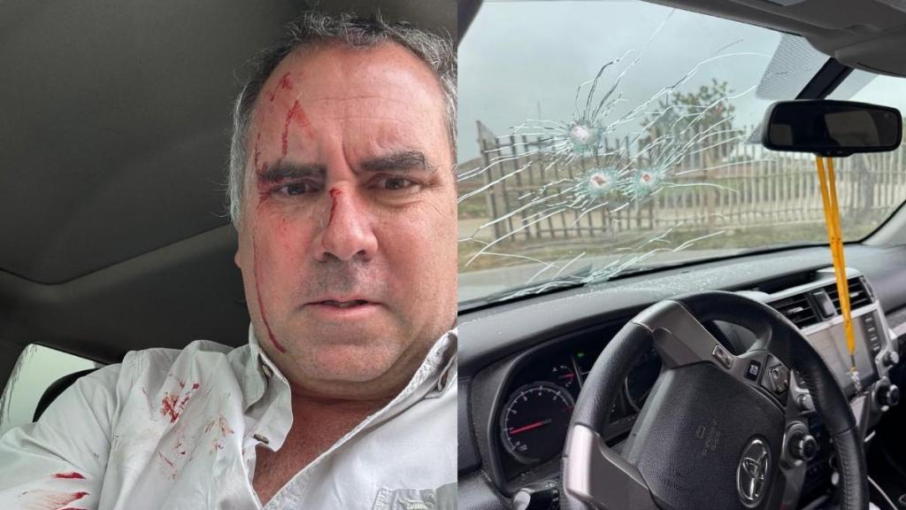 El candidato presidencial peruano, Rafael Belaunde, tras el tiroteo.