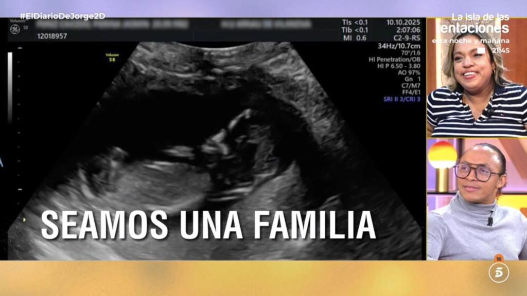 Danny reacciona a la ecografía en 'El diario de Jorge'