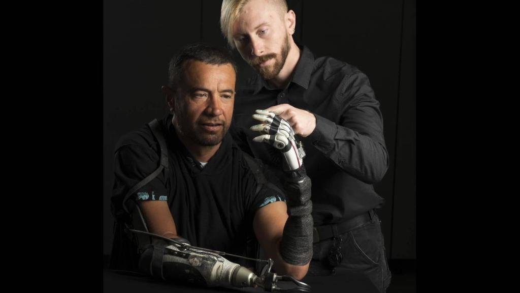 El investigador Marshall Trout con uno de los amputados receptores de la extremidad biónica.