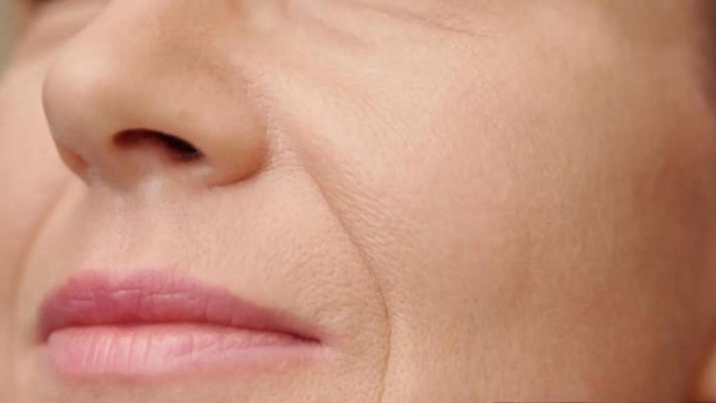 Mujer con el surco nasogeniano marcado.