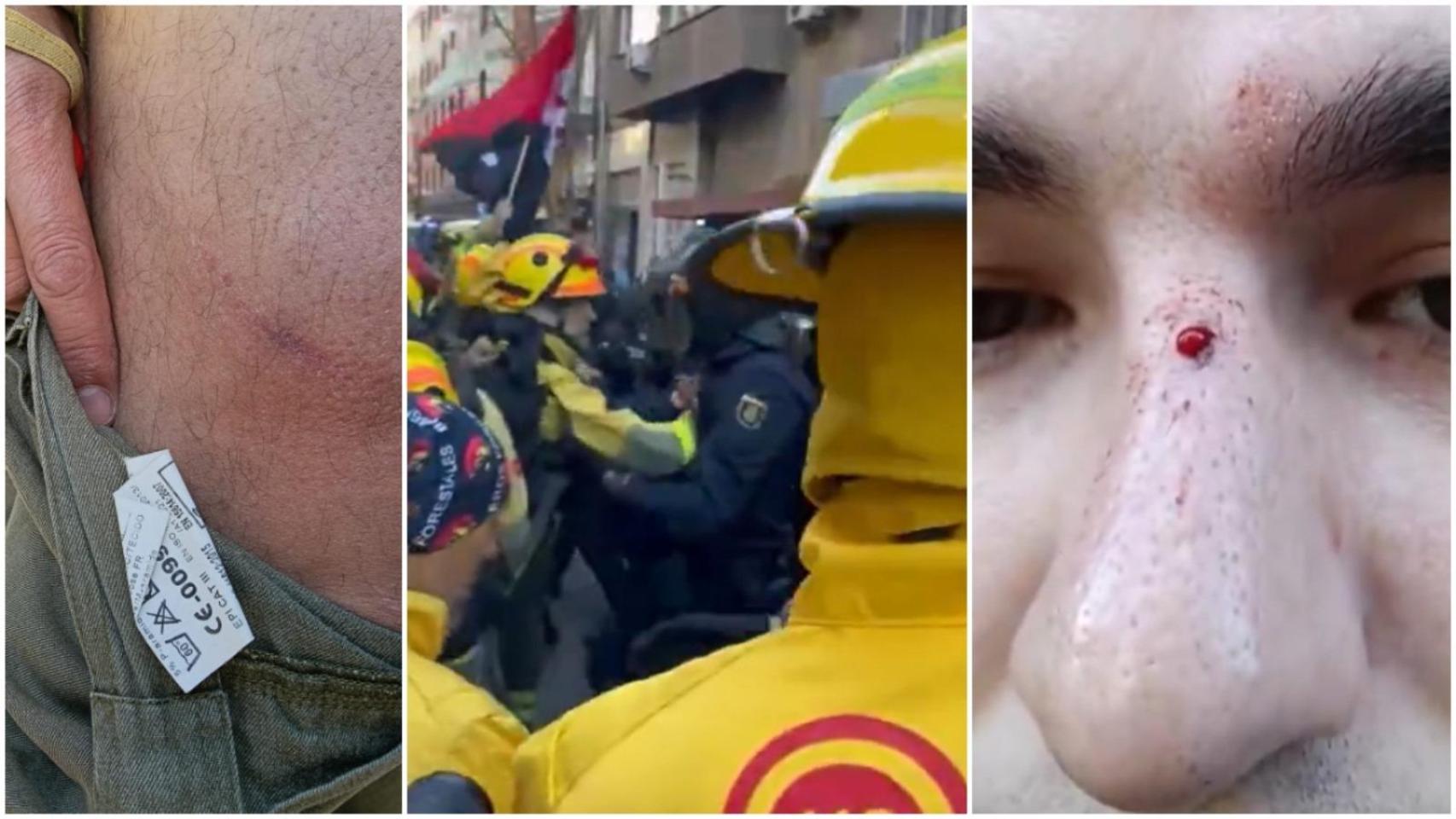 Las protestas de los bomberos de Madrid.
