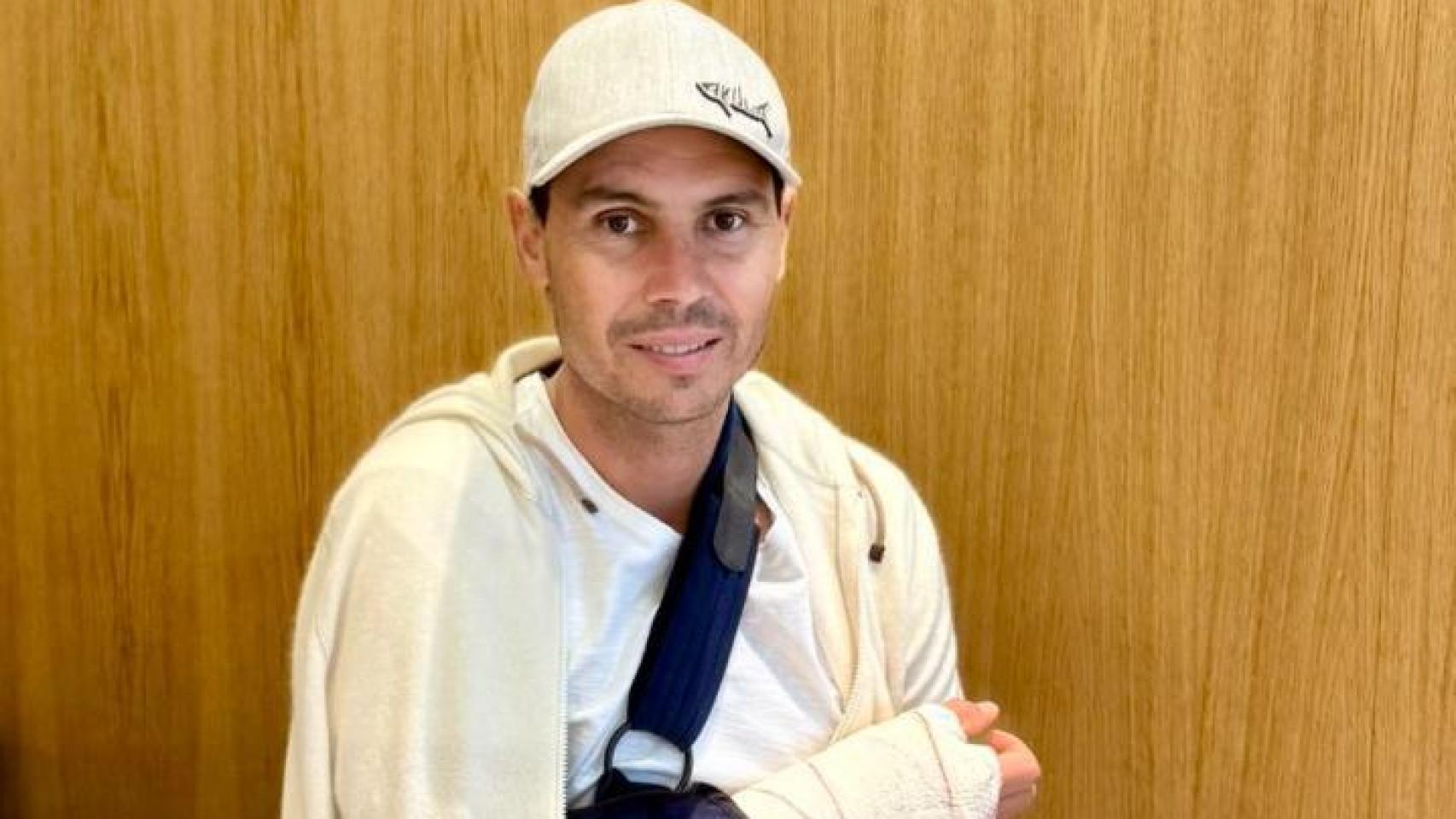 Rada Nadal, operado de la mano debido a una artrosis en la articulación trapecio-metacarpiana.