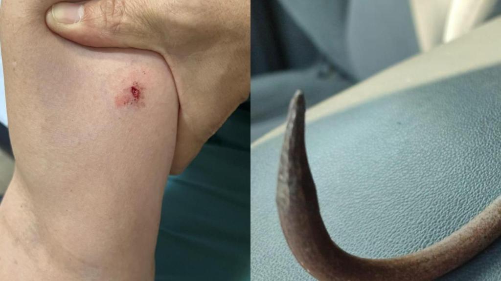 A la izquierda, el brazo del agente herido; a la derecha, el garfio utilizado.