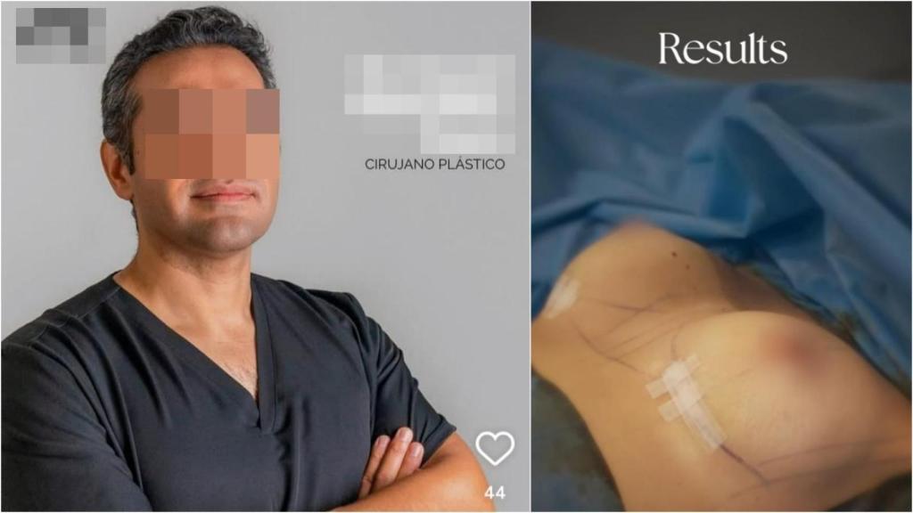 El doctor encarcelado gozaba de una gran fama en las operaciones de aumento de pecho.