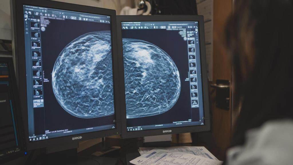 La radióloga revisa con atención una de las pruebas que atiende a lo largo de la jornada.