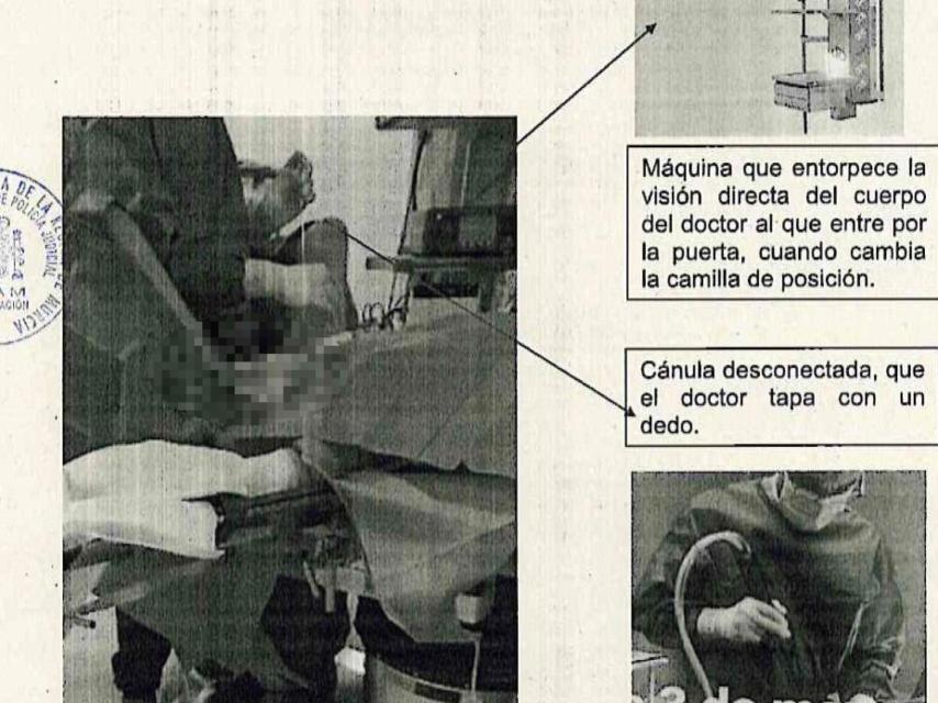 La imagen que analiza la UFAM apuntando a que el doctor David colocó algunas máquinas para que no se viera su cuerpo.