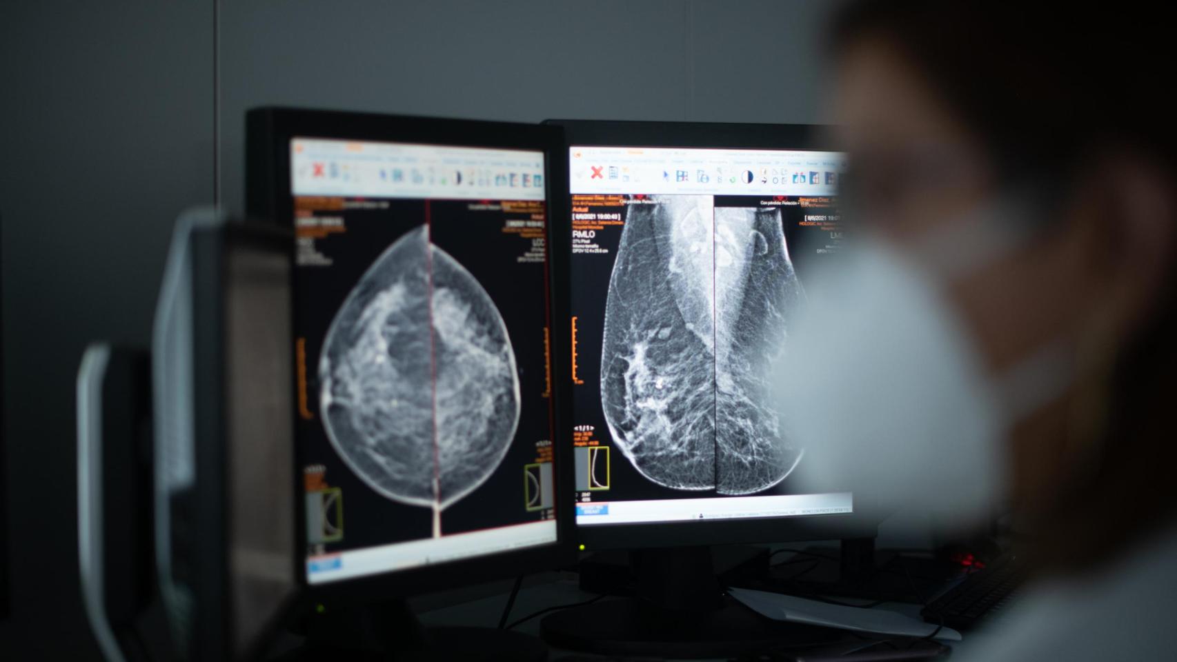 El test permitiría identificar qué mujeres jóvenes están en riesgo de desarrollar un cáncer.