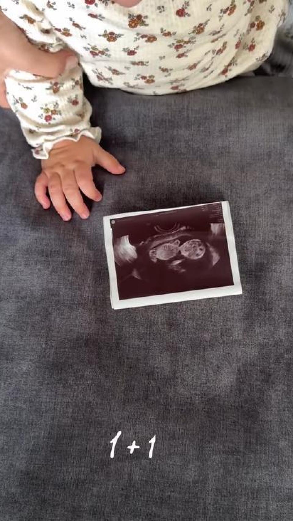 Alba Silva y Sergio Rico han anunciado en las redes sociales que esperan su segundo hijo en común.