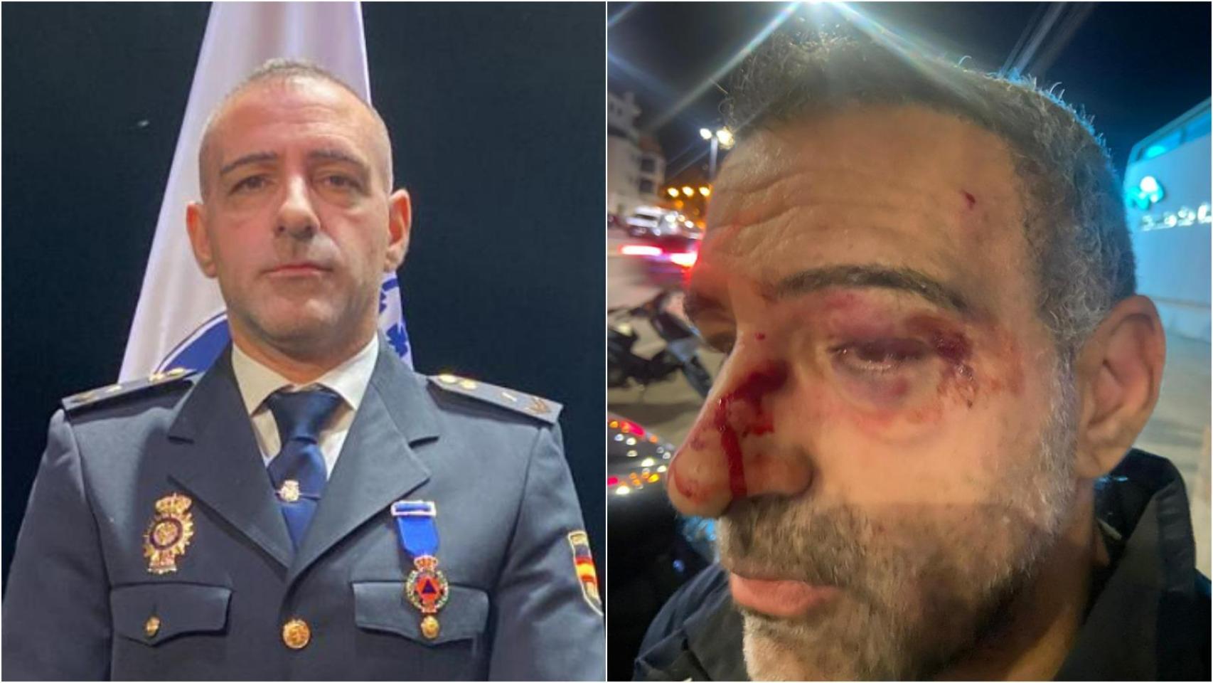 Gabriel, de uniforme cuando recibió una condecoración de Protección Civil en Alcantarilla por evitar un suicidio. Al lado, una imagen suya tras recibir el golpe del repartidor con su casco.